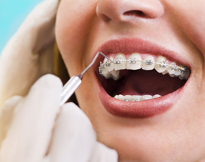 verident-terape-ortodonzia