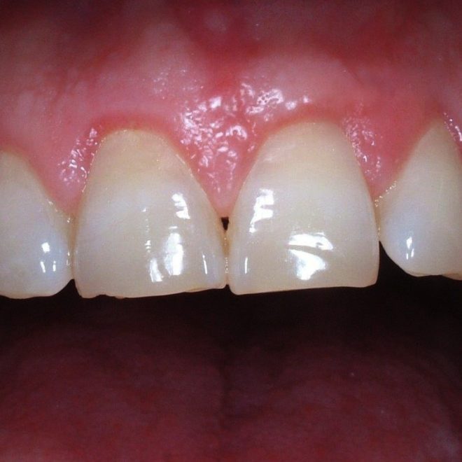 verident-terapie-chirurgia-mini-invasiva (2)
