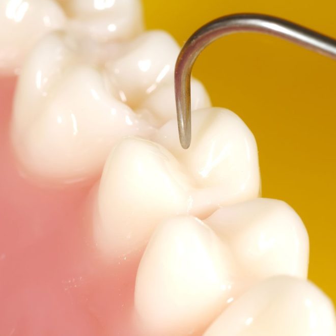 verident-terapie-conservativa-estetica