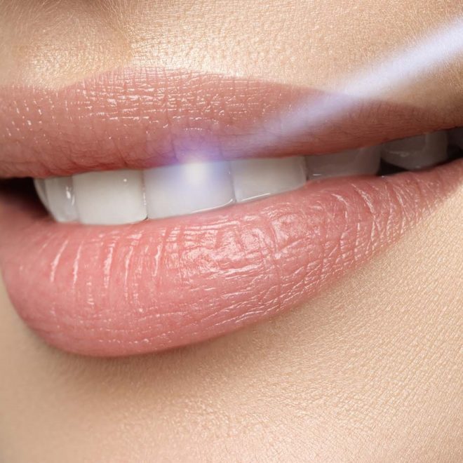 verident-terapie-laser-a-diodi