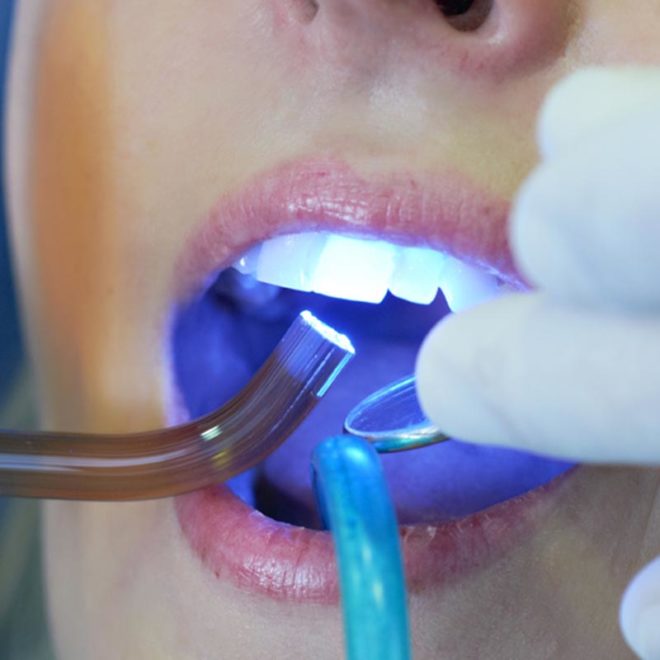 Woman having teeth examined at dentists