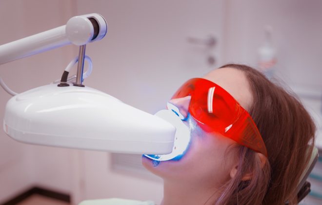 verident-terapie-sbiancamento-dentale