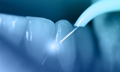 verident_parodontologia